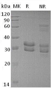 Recombinant Human Integral Membrane Protein 2B/ITM2B/imBRI2 (C-6His)
