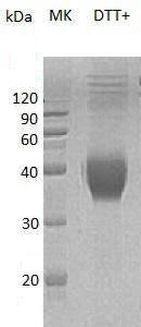 Recombinant Mouse GITR/TNFRSF18/CD357 (C-Fc-6His)