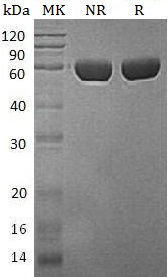 Recombinant Human Serine Carboxypeptidase CPVL/VCP-Like Protein (C-6His)
