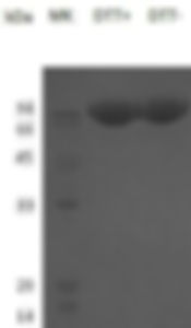 Recombinant Human N-Acetylglucosamine-6-Sulfatase/GNS (C-6His)