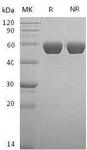 Recombinant Human Serpin A1/alpha-1-Antitrypsin (C-6His)