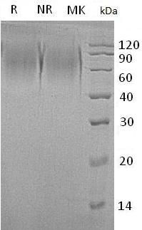 Recombinant Human Mucin-15/MUC15 (C-6His)