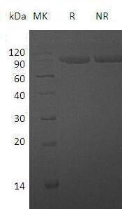 Recombinant Human IL-1 Receptor Type 2/IL-1R-2 (C-Fc)
