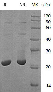 Recombinant Human TMX2/TXNDC14 (N-6His)