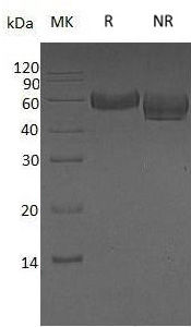 Recombinant Human Fetuin-A/AHSG/α-2-HS-Glycoprotein/AHSG (C-6His)