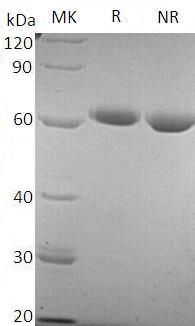 Recombinant Human 5'-Nucleotidase/5'-NT/CD73 (C-6His)