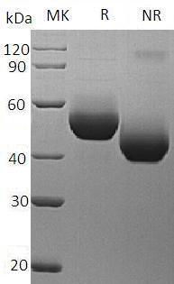 Recombinant Mouse Interleukin-5 Receptor Subunit Alpha/IL-5 Rα (C-6His)