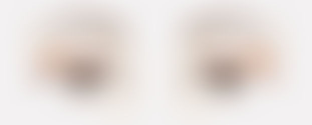 Como levantar olhos caídos