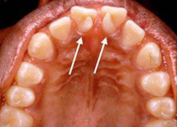 Strange but True: 10 Unique Dental Conditions You’ve Probably Never Heard Of