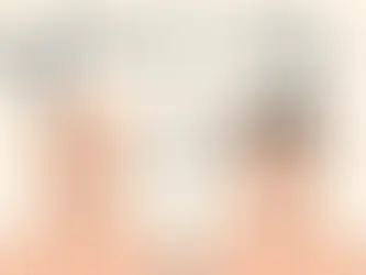 Tricopigmentation Vs Greffe de cheveux