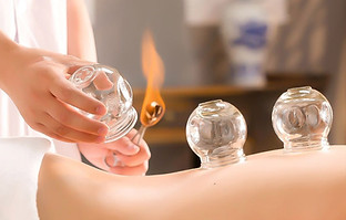 Ventosas Viña del Mar, Medicina China Viña del Mar, Medicina China Concón, Acupuntura Viña del Mar, Acupuntura Concón