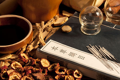 Traditional Chinese Medicine supplies incuding acupuncture needles, glass cups, and TCM herbs