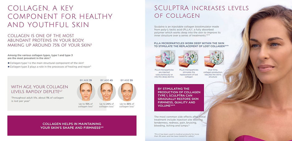 Sculptra how it works