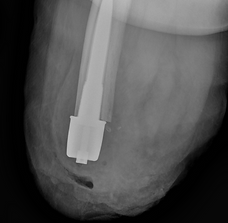 48_POP06 S1 89270140_edited.png