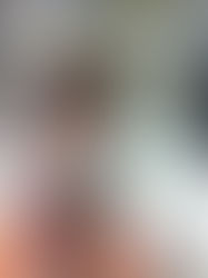 ЛАРИНГОТРАХЕАЛЬНАЯ ПЛАСТИКА В ЛЕЧЕНИИ СТЕНОЗОВ ГОРТАНИ И ТРАХЕИ У ДЕТЕЙ В ИЗРАИЛЕ.