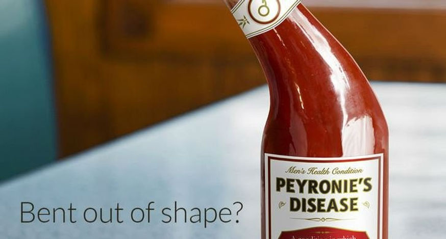 Peyronie's Disease
