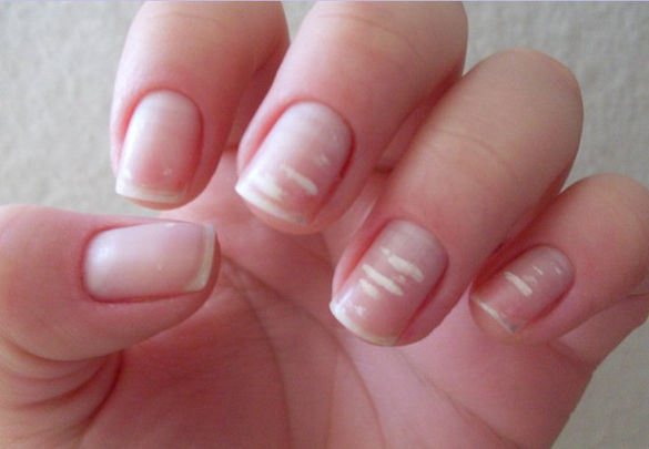 Unhas: Cuidados e manchas brancas