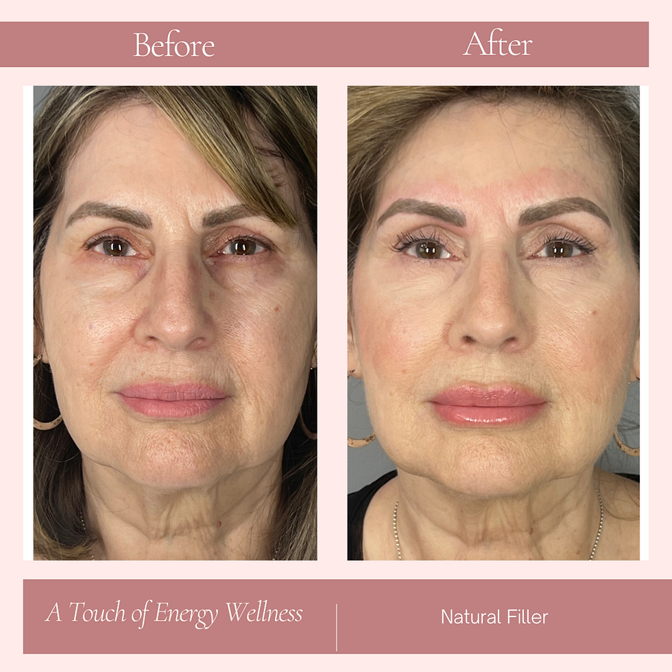 EzGel (natural filler)