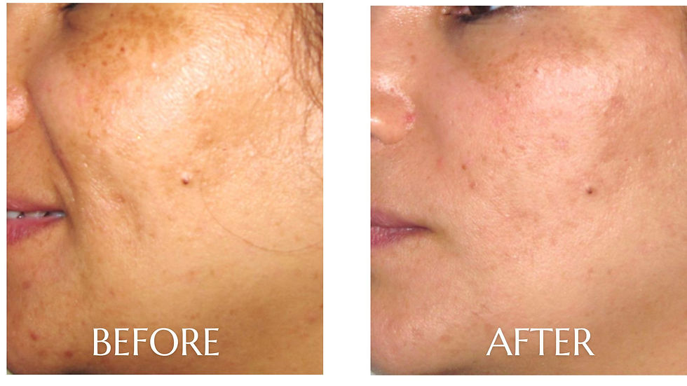 Before (2).jpg