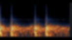 Thumbnail: Heartbeat, Regular, Single, 01-01, LOOP