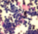 jsap12134-fig-0002-m_edited.jpg