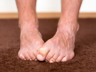 Did you know Cannabis Can Help Decrease the Pain from Peripheral Neuropathy?