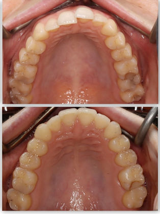 suresmile2 (1).jpg