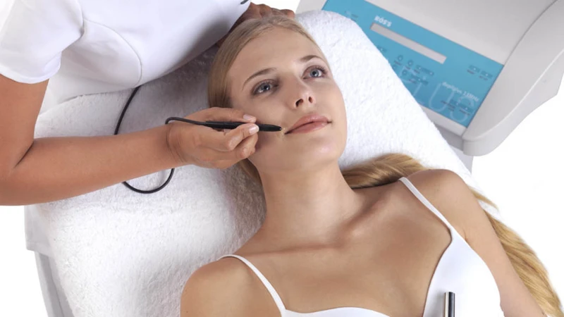 kurzy elekrtoepilace  v CŘ