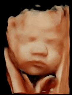Motion graphic of a high definition (HD) ultrasound pregnancy scan.