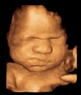 Motion graphic of a 4D ultrasound pregnancy scan.