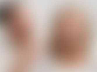 Clareamento dental no Dia dos Namorados: sorria com mais confiança nessa data especial