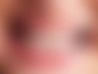 A importância do tratamento ortodôntico para a saúde e a autoestima