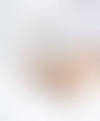 Whats Laser Hair Removal? Frequency?