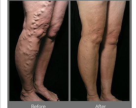 Before-After-2 (1).jpg