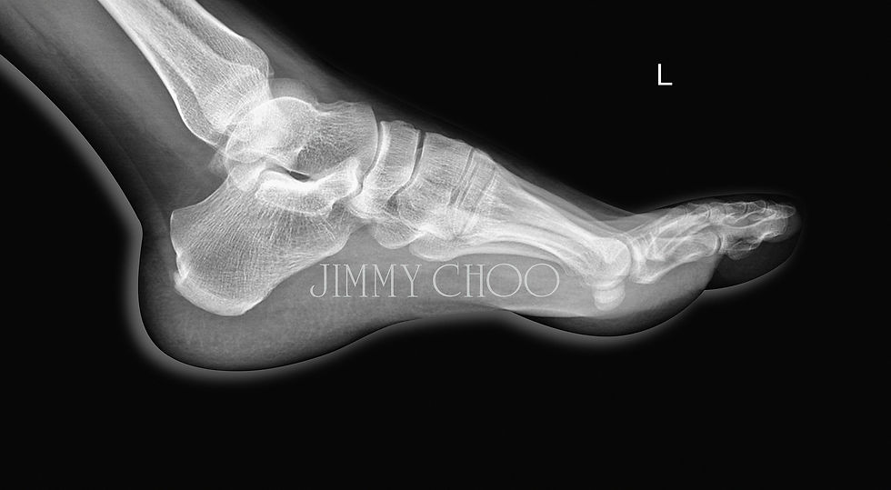Foot 1- Black Edition