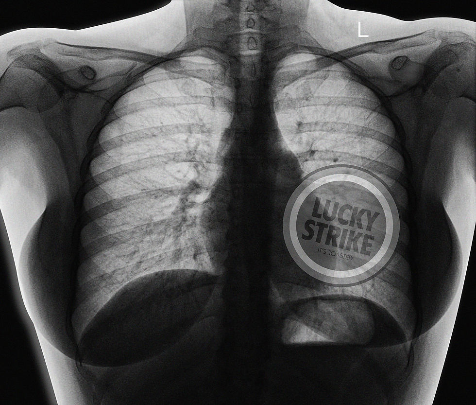Chest 1- Female - Black Edition