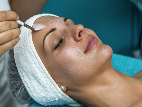Chemical Peel Ottawa: Clear Skin Solution