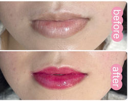 LIP4_edited