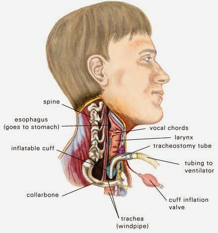 trach and throat