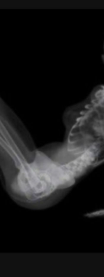 XRAY OF WOMAN;S SKELETON