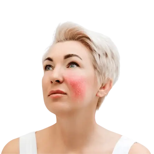 Découvrez nos solution anti taches Rosacée avec la gamme Esthederm Sensy, le Ipl , la thermocoagulation