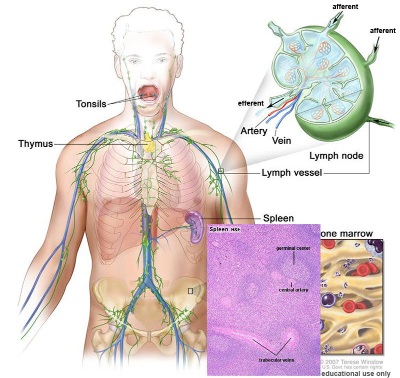 Lymphoma-4.jpg