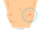 Breast-Cancer-Symptoms-768x560.jpg