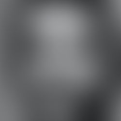 Cabelo ralo: o que fazer, o que observar e onde os cuidados naturais entram