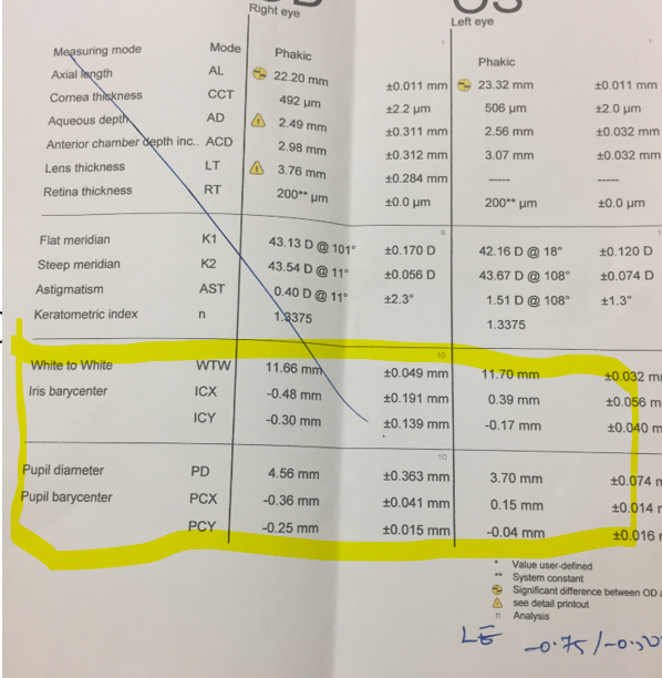 Image 12: Follow the X/Y coordinate values to rule out major decentration in the eye. PCX and PCY indicates decentration of pupil barycenter from corneal vertex/visual axis quickguide.org