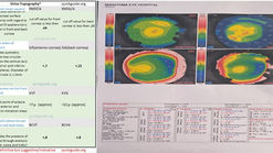 Sirius Topography Indices