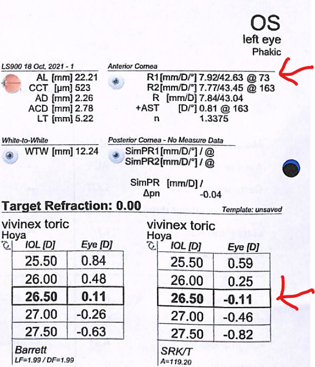 Image 1 Note the astigmatism of .81 diopters. The corresponding standard IOL power calculated is 26.50 as per SRK T providing a spherical equivalent (SE) of -.11. This is not a value that indicates patient's emmetropia quickguide.org