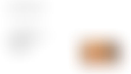 Podcast - Posterior Capsular Opacificaion in 5 minutes