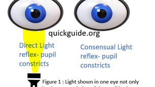Pupil Test - A Key Element in Multifocal IOL Candidacy