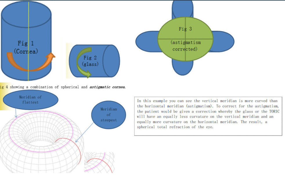 Understanding Astigmatism or cylinder and how it is corrected by